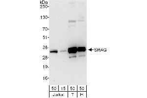 anti-Chromatin Target of PRMT1 (CHTOP) (AA 1-50) antibody