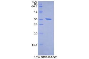 SDS-PAGE (SDS) image for Metallothionein 1E (MT1E) (AA 1-61) protein (His tag,GST tag) (ABIN1821726) (MT1E Protein (AA 1-61) (His tag,GST tag))