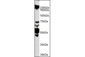 Antibody (1 µg/ml) staining of HUVEC lysate (35 µg protein in RIPA buffer). (ROBO1 抗体  (Internal Region))
