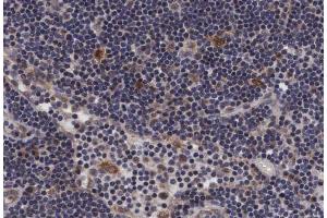 Immunohistochemistry (IHC) image for anti-Protein tyrosine Phosphatase, Non-Receptor Type 1 (PTPN1) (pSer50) antibody (ABIN6256357)