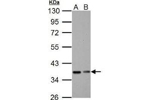 Western Blotting (WB) image for anti-Nuclear Factor of kappa Light Polypeptide Gene Enhancer in B-Cells Inhibitor, alpha (NFKBIA) (Center) antibody (ABIN2856763)