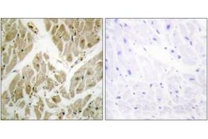 Immunohistochemistry analysis of paraffin-embedded human heart tissue, using API-5 Antibody. (Apoptosis Inhibitor 5 抗体  (AA 421-470))