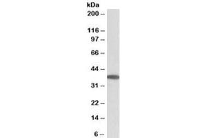 Western blot testing of human duodenum lysate with MOGAT2 antibody at 0. (MOGAT2 抗体)