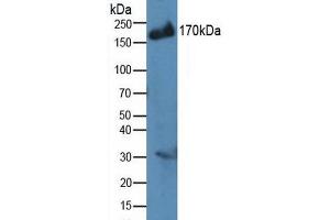 Western blot analysis of Human MCF7 Cells. (IRS2 抗体  (AA 985-1255))