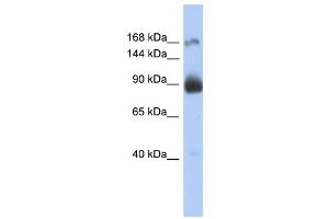 INSR antibody (70R-10509) used at 2. (Insulin Receptor 抗体  (Middle Region))