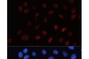 Immunofluorescence analysis of U-2 OS cells using SUMO1 Polyclonal Antibody at dilution of 1:100. (SUMO1 抗体)