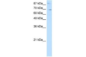 WB Suggested Anti-SKIL Antibody Titration:  2. (SKIL 抗体  (N-Term))