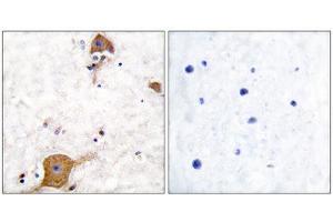 Immunohistochemistry (IHC) image for anti-Neuregulin 1 (NRG1) (Isoform 10), (N-Term) antibody (ABIN1848606) (Neuregulin 1 抗体  (Isoform 10, N-Term))