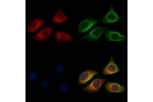 ABIN6258512 and ABIN6274729 staining Hela cells by IF/ICC. (MRPL13 抗体  (C-Term))