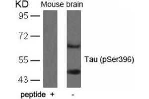 Image no. 1 for anti-Microtubule-Associated Protein tau (MAPT) (pSer396) antibody (ABIN196791) (MAPT 抗体  (pSer396))