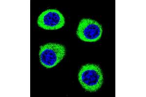 Confocal immunofluorescent analysis of CPSF3L Antibody (N-term) (ABIN655113 and ABIN2844744) with U-251MG cell followed by Alexa Fluor 488-conjugated goat anti-rabbit lgG (green). (CPSF3L 抗体  (N-Term))