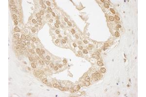 Immunohistochemistry (IHC) image for anti-V-Akt Murine Thymoma Viral Oncogene Homolog 1 (AKT1) (AA 25-75) antibody (ABIN7448406)