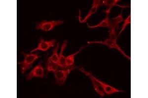 ABIN6267302 staining HepG2 by IF/ICC.