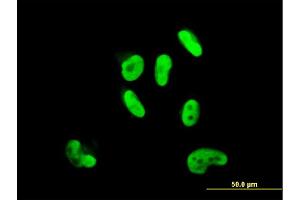 Immunofluorescence of monoclonal antibody to SOX9 on HepG2 cell. (SOX9 抗体  (AA 400-509))