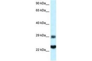 Image no. 1 for anti-Ribosomal Protein S9 (RPS9) (C-Term) antibody (ABIN6747457) (RPS9 抗体  (C-Term))