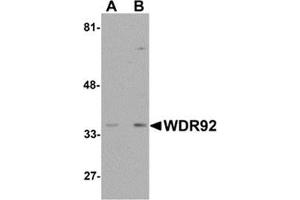 Western blot analysis of WDR92 in human kidney tissue lysate with WDR92 antibody at (A) 1 and (B) 2 μg/ml. (WDR92 抗体  (Center))