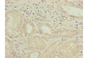 Immunohistochemistry of paraffin-embedded human kidney tissue using ABIN7163868 at dilution of 1:100 (GALNT14 抗体  (AA 35-335))