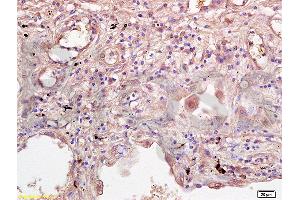 Immunohistochemistry (Paraffin-embedded Sections) (IHC (p)) image for anti-Interleukin 2 Receptor, gamma (IL2RG) (AA 51-150) antibody (ABIN2176981)
