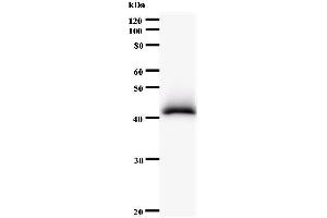 Western Blotting (WB) image for anti-PDS5, Regulator of Cohesion Maintenance, Homolog B (PDS5B) antibody (ABIN931004) (PDS5B 抗体)