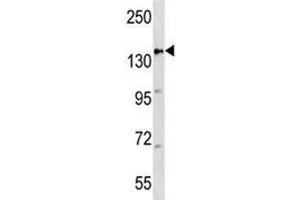 APC antibody western blot analysis in mouse heart tissue lysate (APC 抗体  (AA 1148-1176))