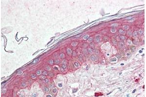 Anti-TSPAN6 antibody  ABIN960831 IHC staining of human skin. (Tetraspanin 6 抗体  (Internal Region))
