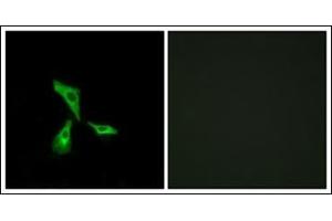 Immunofluorescence analysis of HeLa cells, using GPR101 Antibody. (GPR101 抗体  (C-Term))