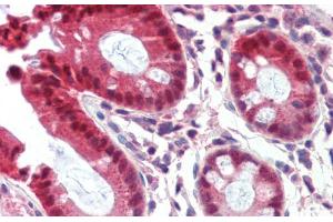 Immunohistochemistry with Human Colon lysate tissue at an antibody concentration of 5. (NR1I3 抗体  (Middle Region))