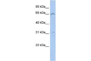 WB Suggested Anti-EFHA2 Antibody Titration: 0. (EFHA2 抗体  (N-Term))