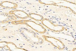 Immunohistochemistry analysis of paraffin-embedded mouse kidney using,TMEM213 (ABIN7075999) at dilution of 1: 2000 (TMEM213 抗体)