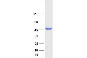 PPM1B Protein (Transcript Variant 2) (Myc-DYKDDDDK Tag)