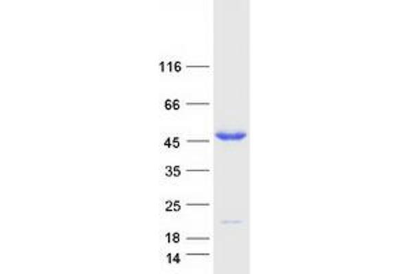 PPM1B Protein (Transcript Variant 2) (Myc-DYKDDDDK Tag)