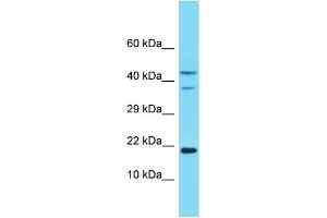 Western Blotting (WB) image for anti-NADH Dehydrogenase (Ubiquinone) 1 alpha Subcomplex, 8, 19kDa (NDUFA8) (Middle Region) antibody (ABIN2774343) (NDUFA8 抗体  (Middle Region))