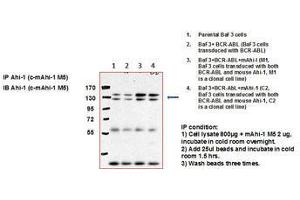 Image no. 1 for anti-Abelson Helper Integration Site 1 (AHI1) (C-Term) antibody (ABIN790758) (AHI1 抗体  (C-Term))