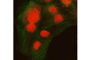 IF analysis of SNRNP200 and Tubulin beta using anti-SNRNP200 antibody (ABIN7602032) and anti-Tubulin beta antibody (ABIN7602744). (SNRNP200 抗体  (AA 557-2129))