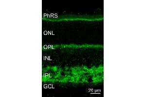 Indirect immunostaining of a PFA fixed mouse retina section (dilution 1 : 5000). (SCAMP1 抗体  (AA 2-15))