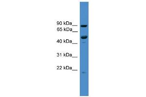 WB Suggested Anti-C3orf59 Antibody Titration: 0. (MB21D2 抗体  (C-Term))