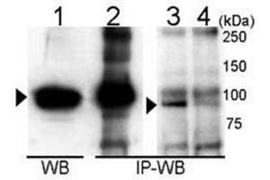 Immunoprecipitation and Western blot analysis of anti-UVRAG Antibody  in 293T cells. (UVRAG 抗体  (C-Term))