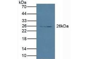 Detection of PRSS2 in Porcine Pancreas lysate using Polyclonal Antibody to Protease, Serine 2 (PRSS2) (PRSS2 抗体  (AA 24-241))