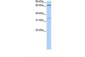Image no. 1 for anti-Peptidyl Arginine Deiminase, Type II (PADI2) (AA 344-393) antibody (ABIN6738820)