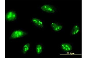 Immunofluorescence (IF) image for anti-NOP14 Nucleolar Protein (Nop14) (AA 1-806) antibody (ABIN522068)