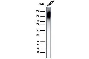 Western Blot Analysis of Human Brain Tissue Lysate using Neurofilament Mouse Monoclonal Antibody (NF421). (NEFH 抗体)