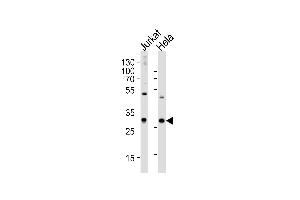 Western blot analysis of lysates from Jurkat, HeLa cell line (from left to right), using CZB Antibody (N-term) 2888a. (CAPZB 抗体  (N-Term))