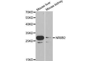 Western blot analysis of extracts of various cell lines, using NR0B2 antibody. (NR0B2 抗体  (AA 1-257))