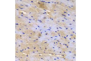 Immunohistochemistry of paraffin-embedded mouse heart using SGCE antibody (ABIN5973070) at dilution of 1/200 (40x lens). (SGCE 抗体)