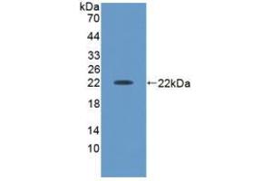 Western blot analysis of recombinant Human ACVA. (ACVA 抗体  (AA 44-178))