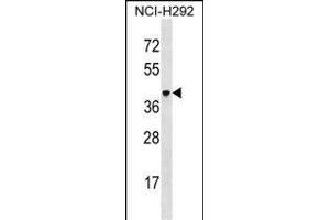 VSIG4 Antibody (C-term) (ABIN1537106 and ABIN2850296) western blot analysis in NCI- cell line lysates (35 μg/lane). (VSIG4 抗体  (C-Term))