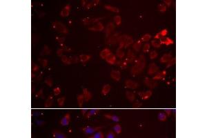 Immunofluorescence analysis of A549 cells using GATM Polyclonal Antibody (GATM 抗体)