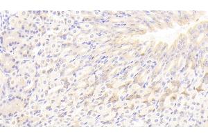 Detection of LIPC in Mouse Stomach Tissue using Polyclonal Antibody to Lipase, Hepatic (LIPC) (LIPC 抗体  (AA 159-415))