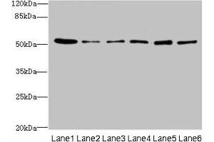 Western blot All lanes: ZNF398 antibody at 3 μg/mL Lane 1: 293T whole cell lysate Lane 2: Hela whole cell lysate Lane 3: HepG2 whole cell lysate Lane 4: Jurkat whole cell lysate Lane 5: Caco-2 whole cell lysate Lane 6: A549 whole cell lysate Secondary Goat polyclonal to rabbit IgG at 1/10000 dilution Predicted band size: 72, 53 kDa Observed band size: 53 kDa (ZNF398 抗体  (AA 401-642))