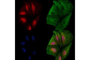 ABIN6260386 and ABIN6279208 staining  cells by IF/ICC. (CABIN1 抗体  (Internal Region))